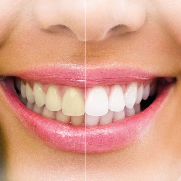 Lucovitaal Activated Charcoal Houtskoolpoeder 50 Gram