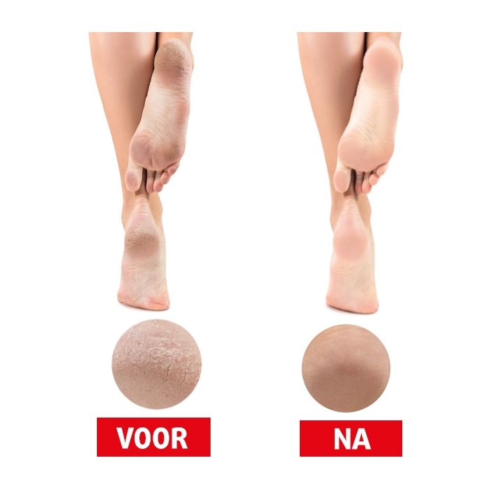 Lucovitaal Douche Voetvijl 1 Stuk